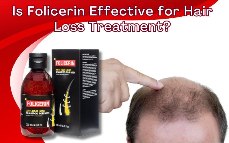 Read more about the article Is Folicerin Effective for Hair Loss Treatment?